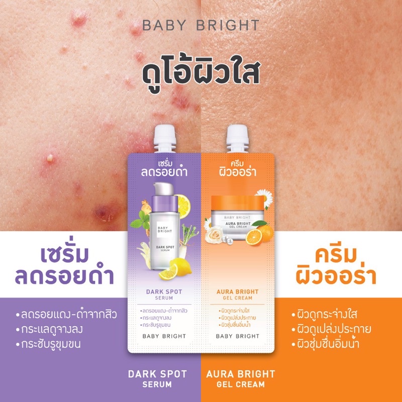 (6ซอง/กล่อง) Baby Bright Duo Booster Dark Spot Serum & Aura Bright Gel Cream เซรั่มลบรอยดำ + ครีมผิวออร่า