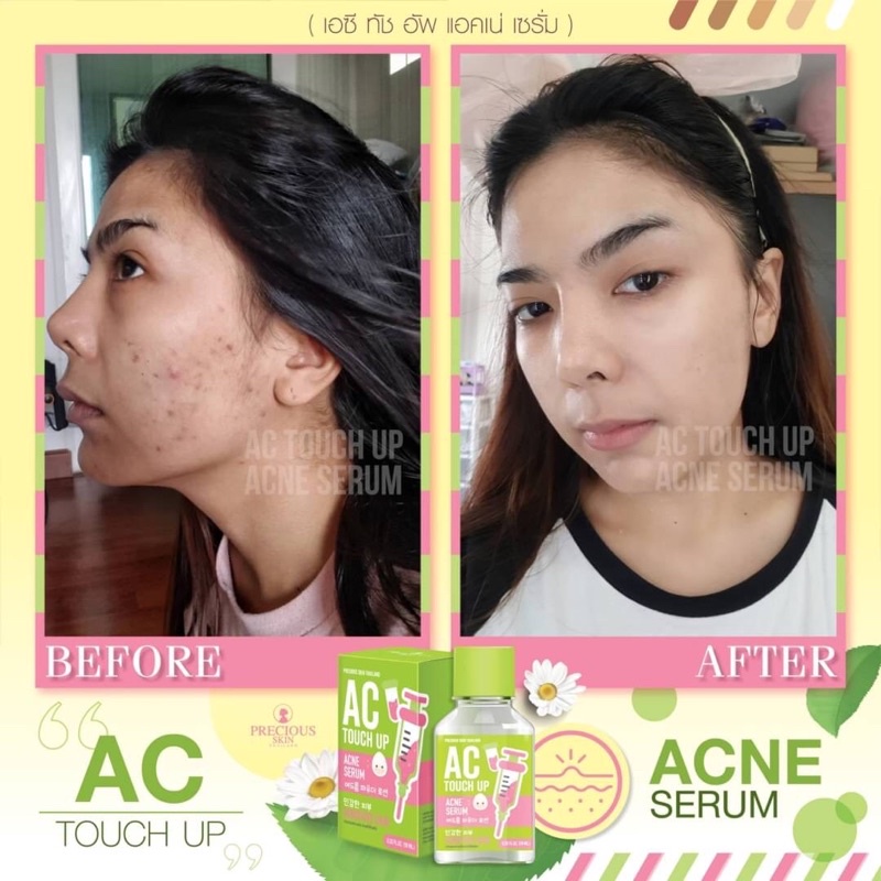 AC Touch Up Acne Serum 10ml เซรั่มลดสืว
