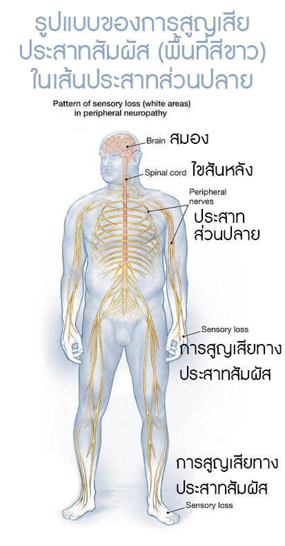 sensory loss