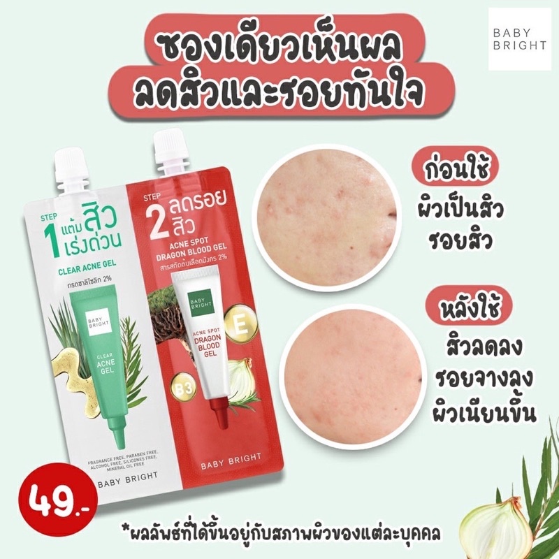 (1ซอง) BABY BRIGHT ครีมซอง 2 หัว 6g+6g เบบี้ไบร์ท Pore blurring / Mela bright / Clear acne gel-acne spot/ Dark spot