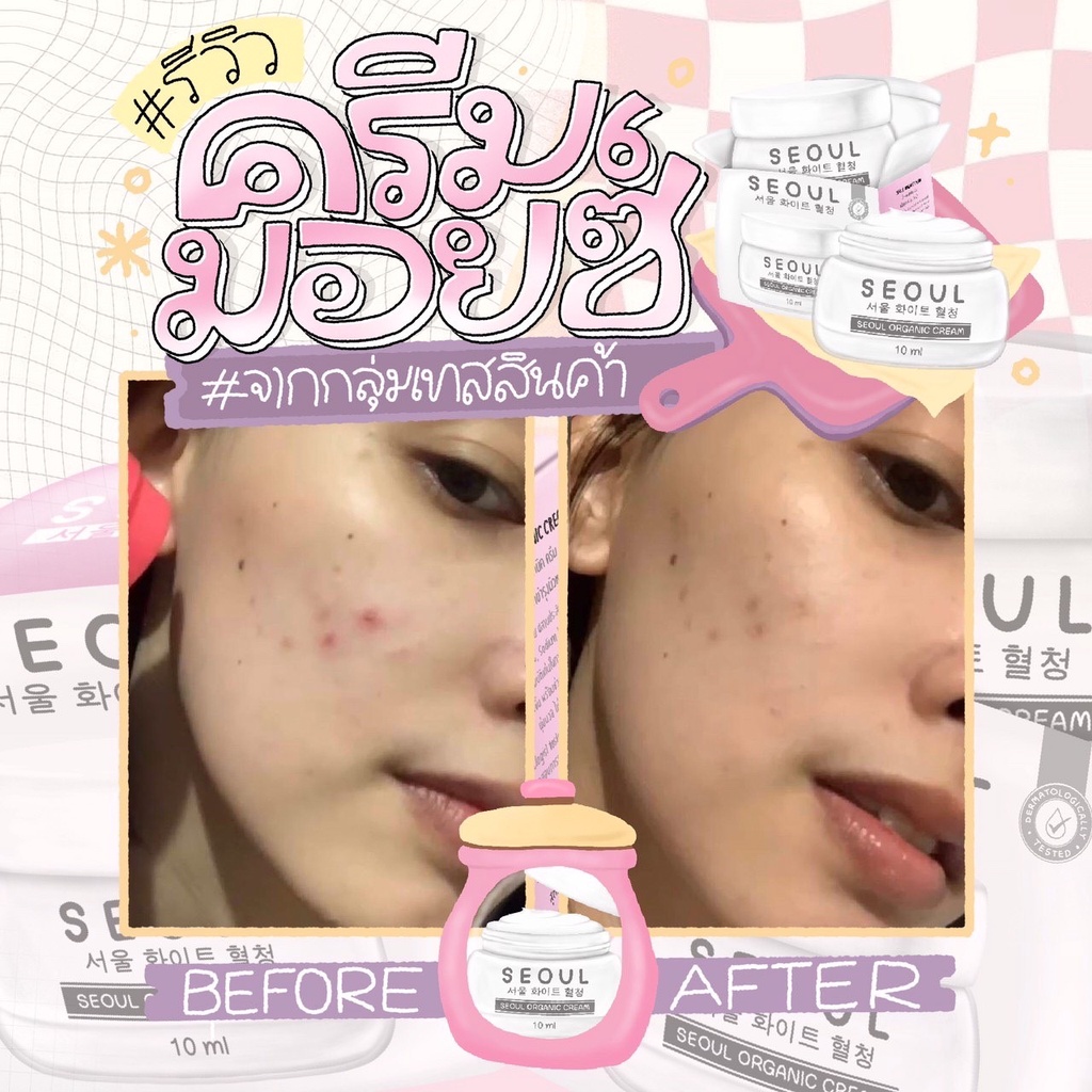 SEOUL 10 ml ครีมมอยซ์ ออแกนิก แบรนด์โซล คุณหมอแนะนำ