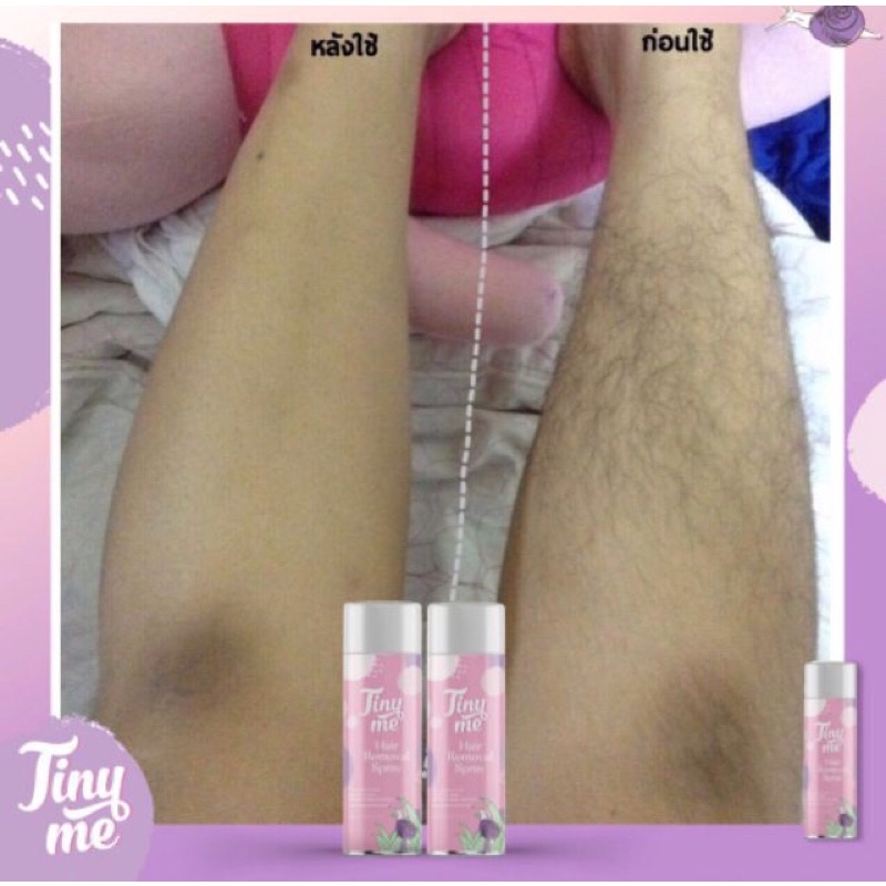 Tiny Me Hair Remover Spray สเปรย์มูสกำจัดขน