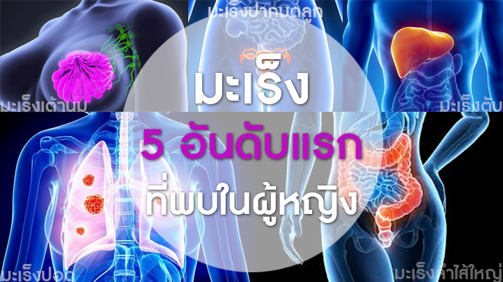5 อันดับมะเร็งที่พบในผู้หญิง