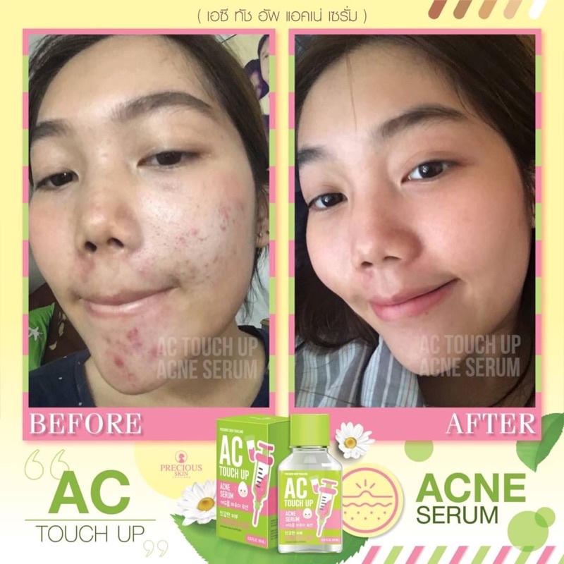 AC Touch Up Acne Serum 10ml เซรั่มลดสืว