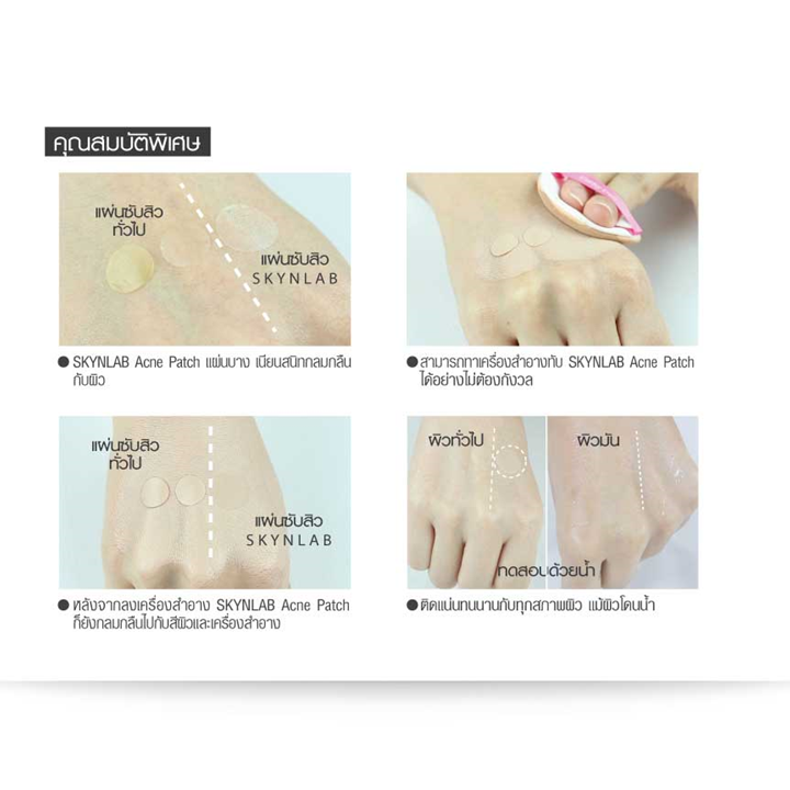 Skynlab Acne Patch 10 ชิ้น แผ่นแปะสิว สกินแล๊บ