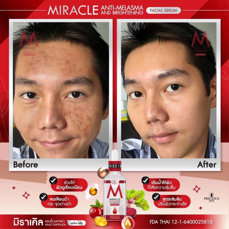 Miracle Anti-Melasma and Brightening Facial Serum 50ml มิราเคิล เซรั่มแก้ฝ้า เซรั่มผิวขาว
