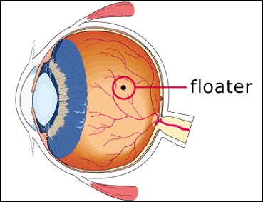 Floater
