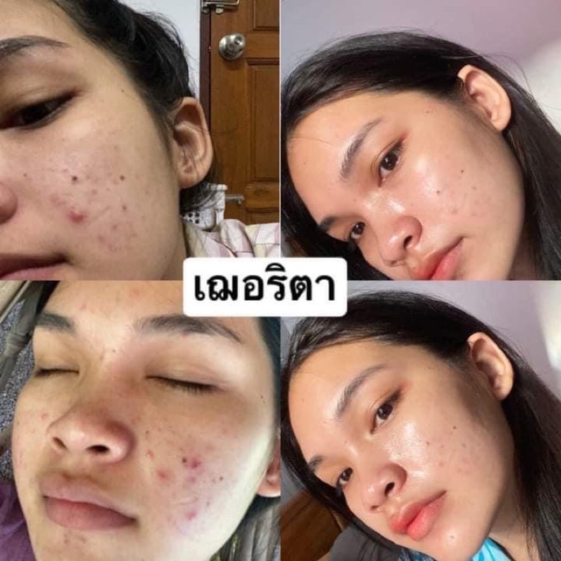 Cherritha โสมเฌอริตา โสมขมิ้นดำ