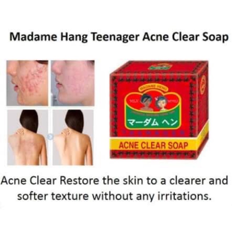 Madam Heng Soap 160g สบู่มาดามเฮง 3 สูตร สูตรต้นตำรับ / สูตรสมุนไพรสำหรับเด็ก / สูตรลดสิว