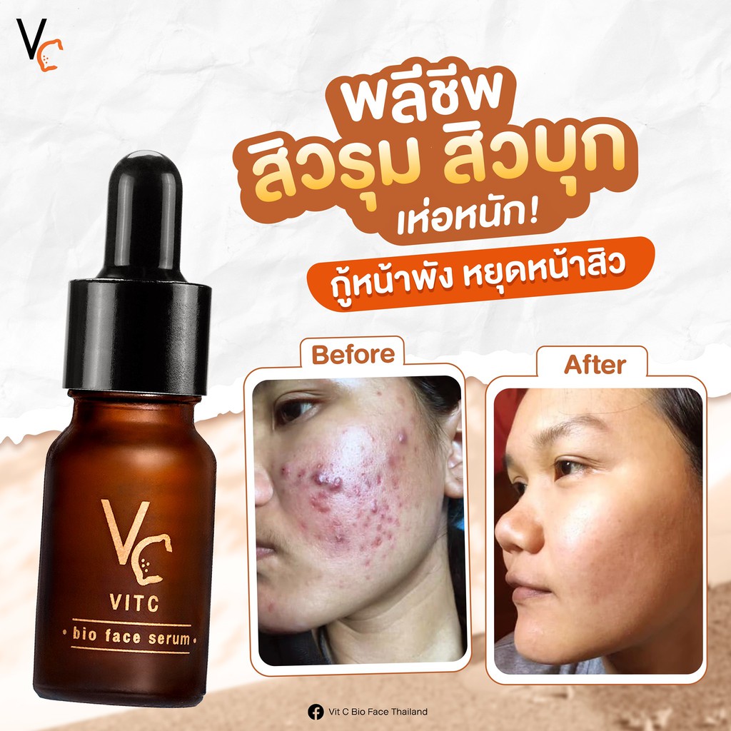 VC Vit C Bio Face Serum 10 ml เซรั่มวิตซีน้องฉัตร 10 มิลลิลิตร