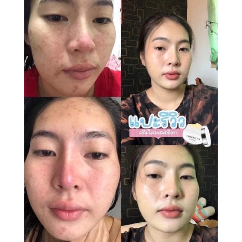 Cherritha โสมเฌอริตา โสมขมิ้นดำ