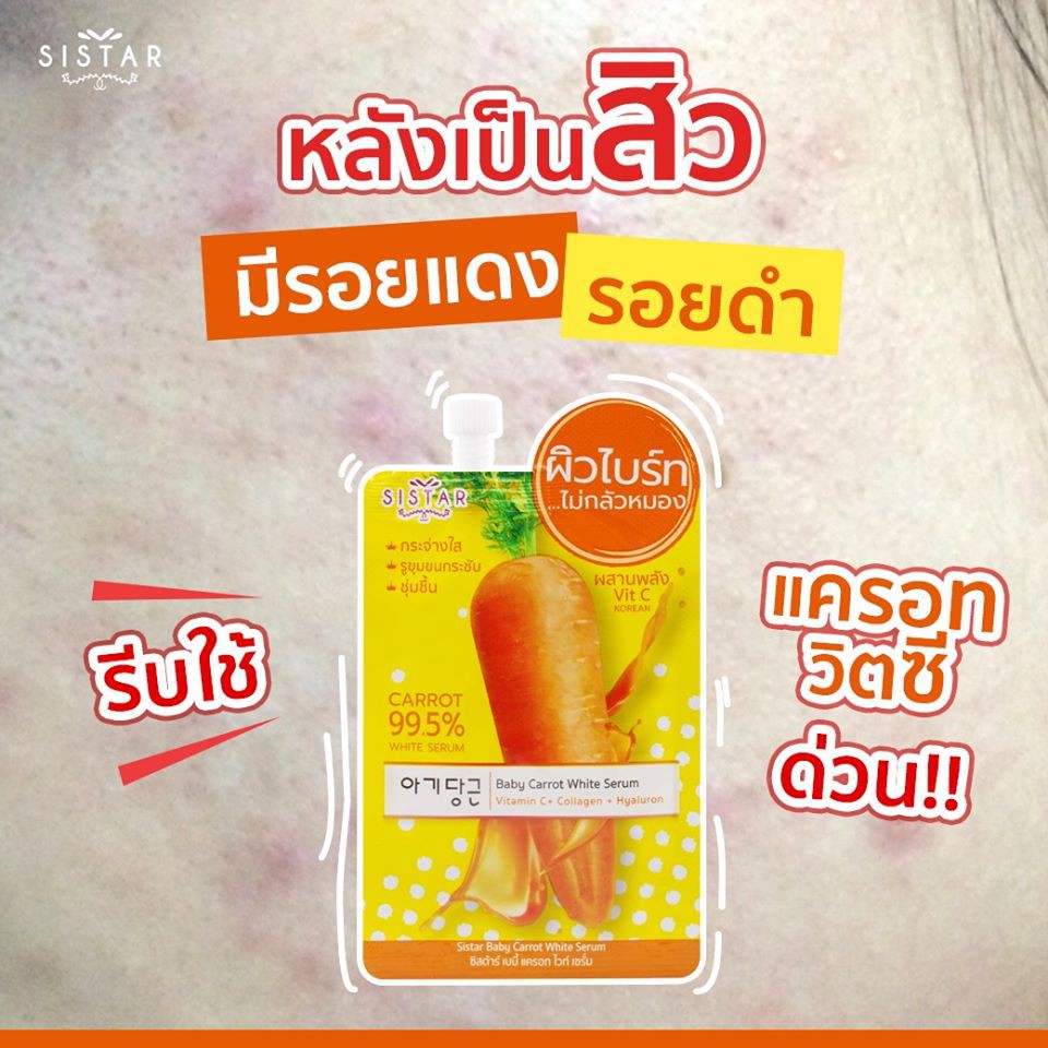 (1ซอง) Sistar EEแตงโม แครอทวิตซี เซรั่มฝ้า รองพื้นแตงโม BBซากุระ โลชั่นแตงโม เจลแตงโม