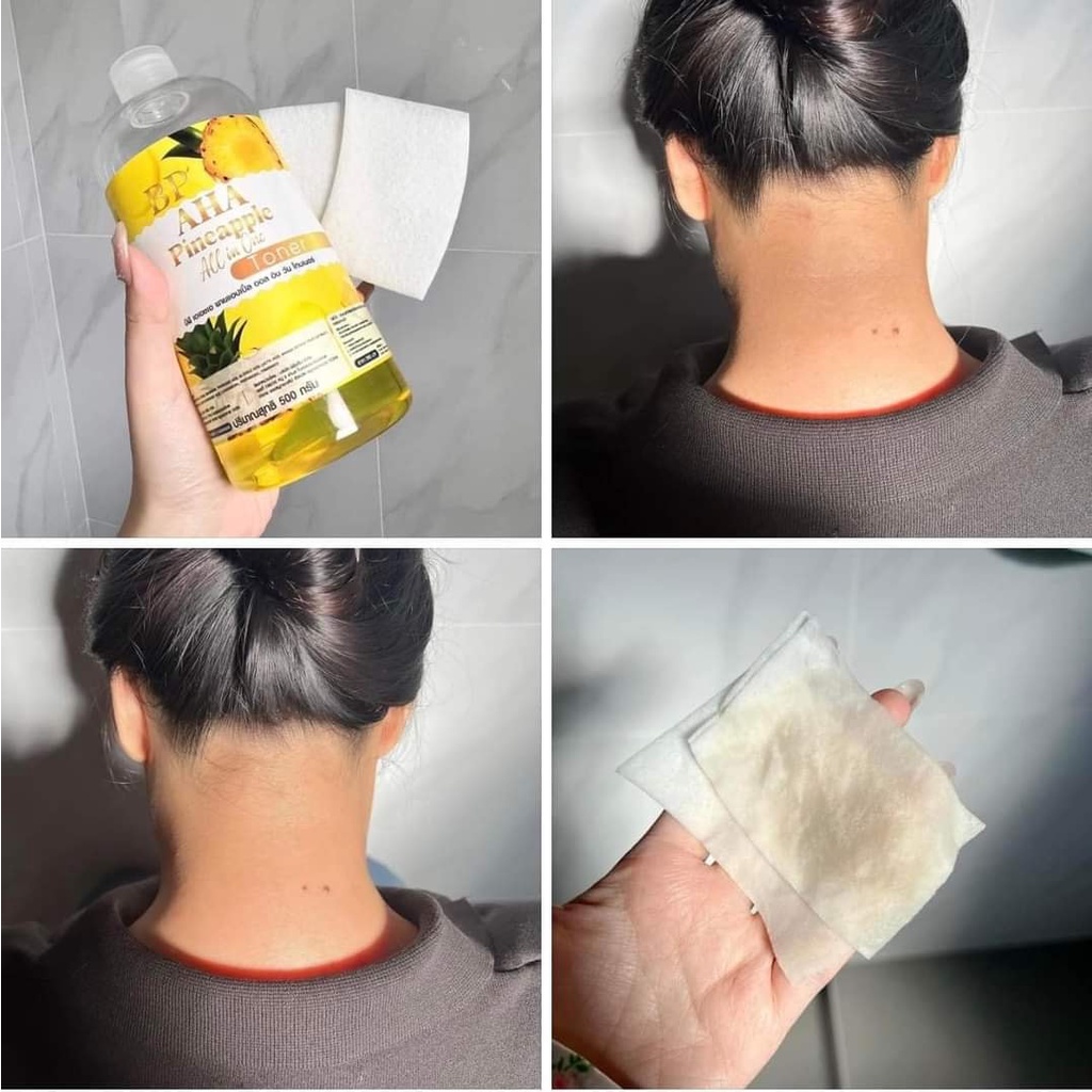 บีพี โทนเนอร์สับปะรด BP AHA Pineapple All in One Toner 500มล.