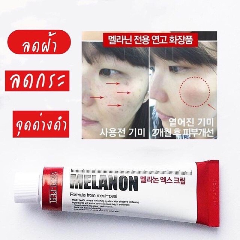 Medi-Peel Melanon X Cream 30 ml สีแดง ครีมลดเลือนกระ ฝ้า