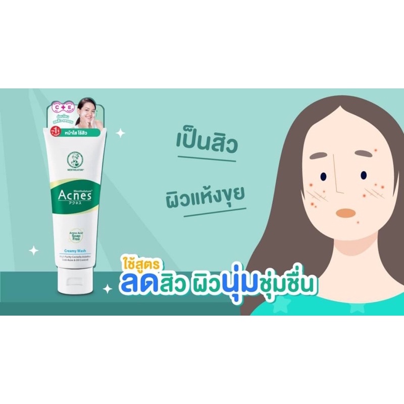 Mentholatum Acnes Creamy Wash 100 ml. โฟมล้างหน้า สำหรับคนเป็นสิว