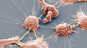 tumor tumor