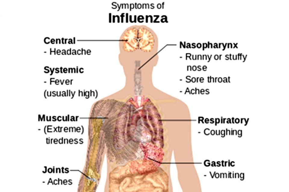 Symptoms-of-influenza