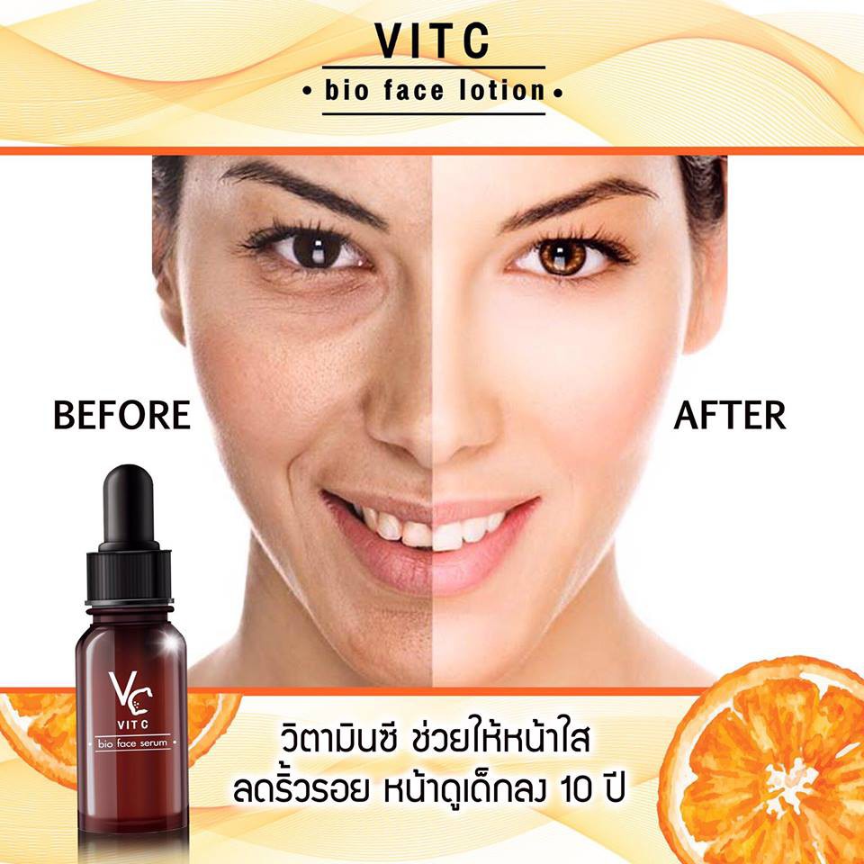 VC Vit C Bio Face Serum 10 ml เซรั่มวิตซีน้องฉัตร 10 มิลลิลิตร