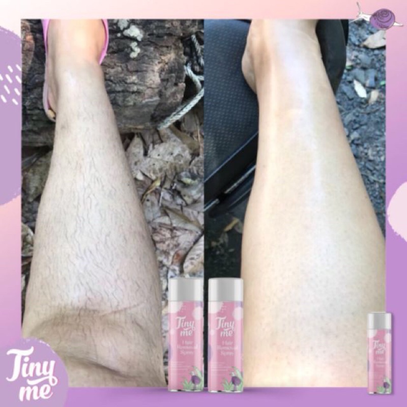 Tiny Me Hair Remover Spray สเปรย์มูสกำจัดขน