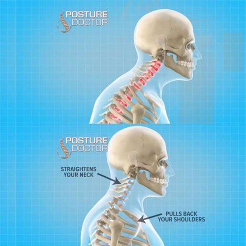 เข็มขัดพยุงหลัง ดัดหลังตรง เสริมบุคลิก POSTURE DOCTOR WH-GE-HE-B2020