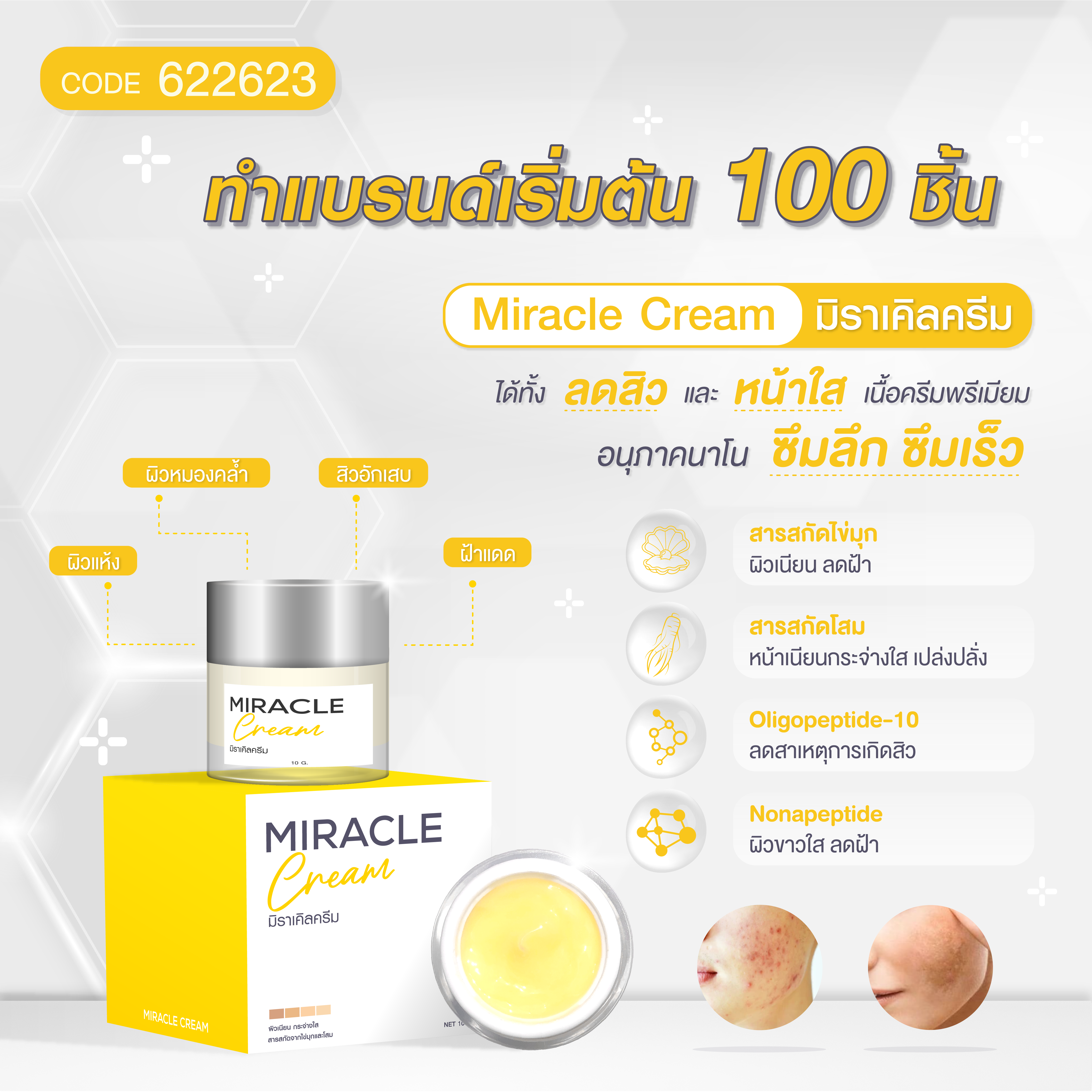ครีมมิราเคิล - MIRACLE CREAM