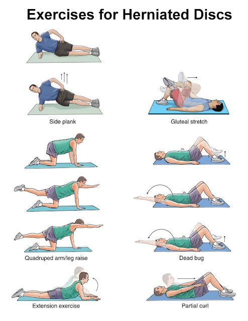 exercises for Herniated disc
