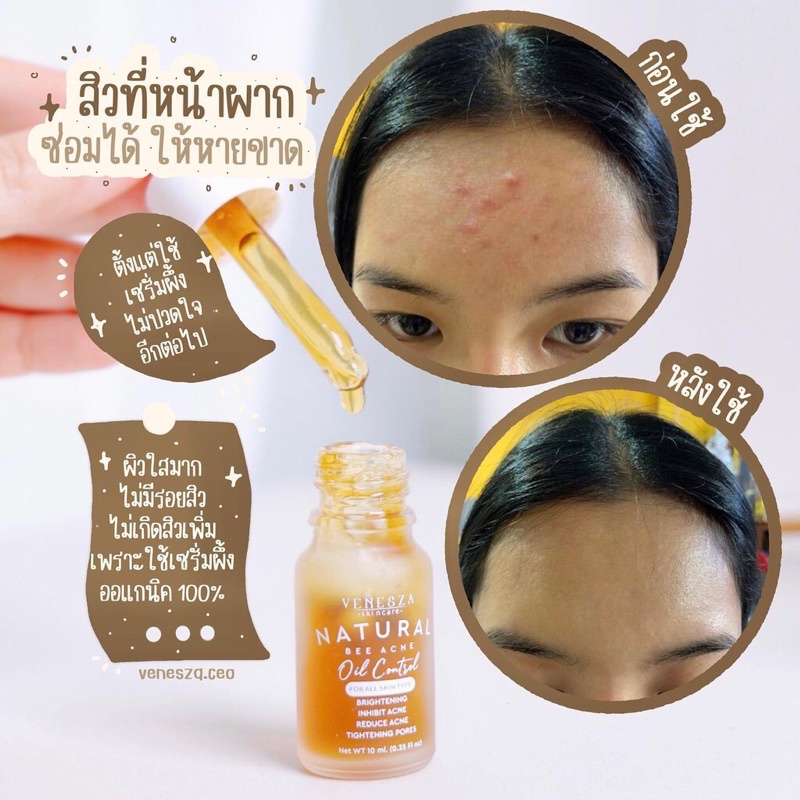 เซรั่มน้ำผึ้ง เวเนสซ่า Venesza Organic Serum 10ML