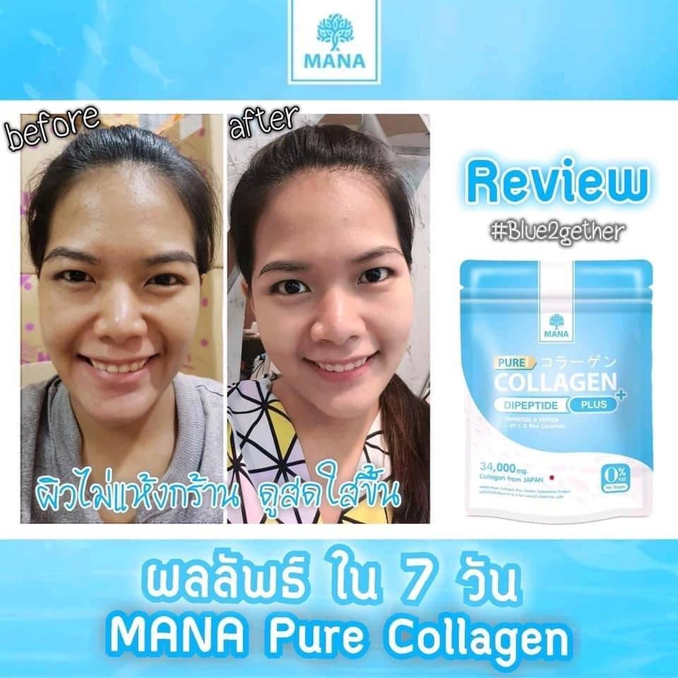 Mana Pure Collagen ดีไหม