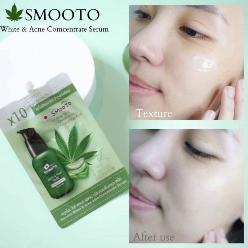 (6 ซอง/กล่อง) Smooto เซรั่ม อัพผิวใส กู้หน้าสิว White & Acne Aloe Concentrate Serum 6ml.