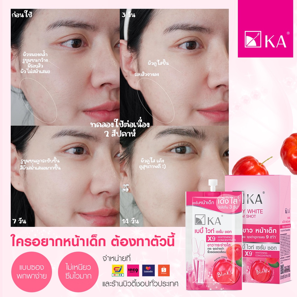 (1ซอง) KA BABY WHITE SERUM SHOT เซรั่มหน้าเด็ก เค.เอ. เบบี้ ไวท์ เซรั่ม ชอท 8มล.