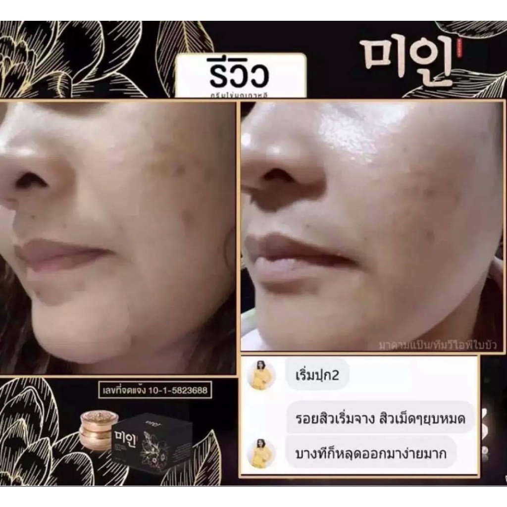 ครีมไข่มุกเกาหลี 5 กรัม GIMMICK บำรุงผิวหน้า Day & Night Cream 5 g.