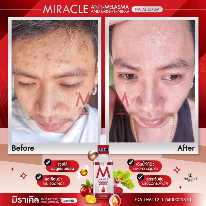 Miracle Anti-Melasma and Brightening Facial Serum 50ml มิราเคิล เซรั่มแก้ฝ้า เซรั่มผิวขาว