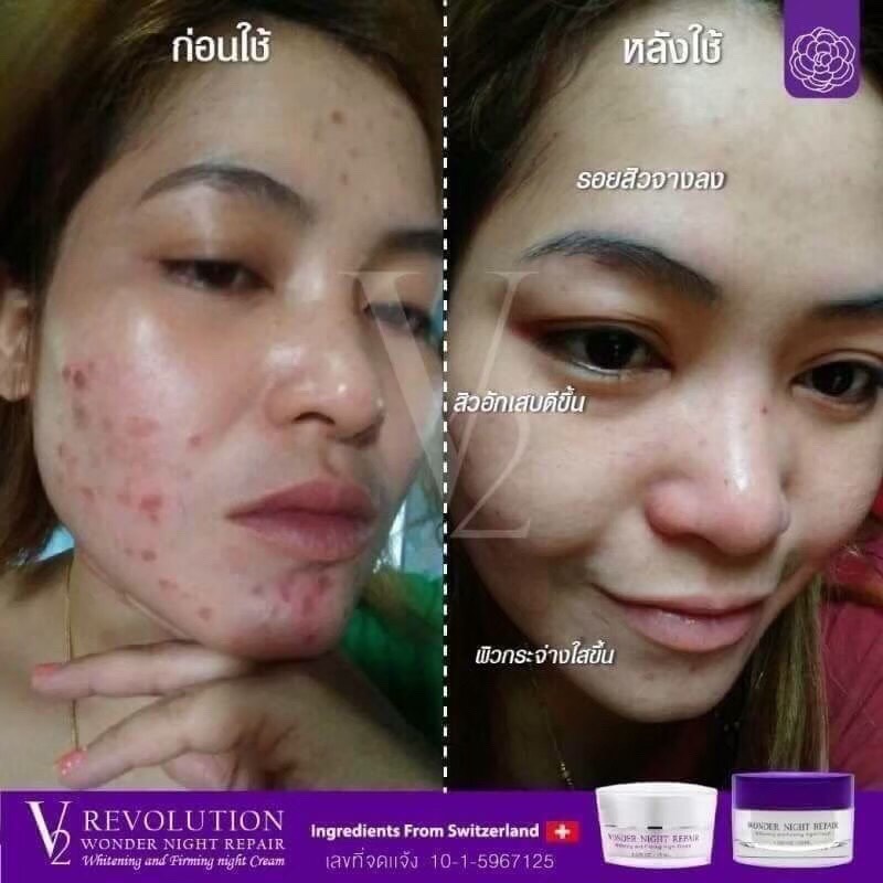 ครีมบำรุงผิวก่อนนอน