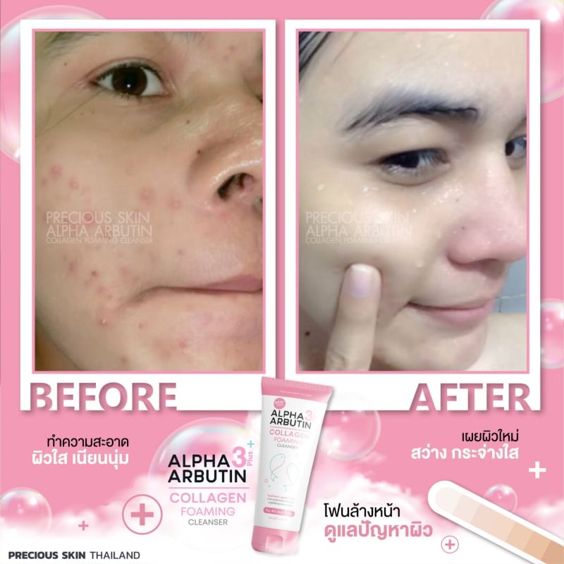 Alpha Arbutin 3+ Collagen Foaming Cleanser 120ml โฟมล้างหน้า คอลลาเจน