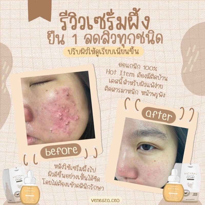 เซรั่มน้ำผึ้ง เวเนสซ่า Venesza Organic Serum 10ML