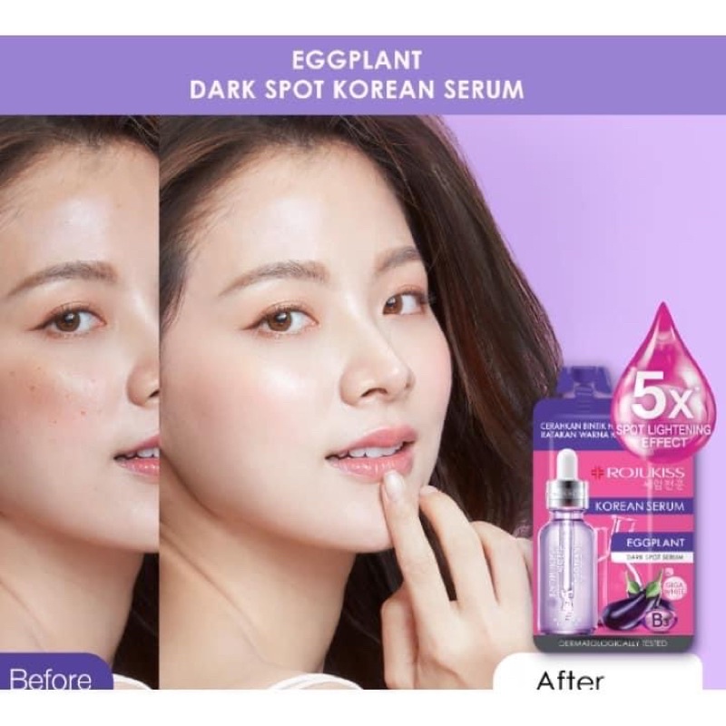 (6ซอง/กล่อง) Rojukiss EGGPLANT DARK SPOT SERUM 8มล. โรจูคิส เอ็กแพลนท์ ดาร์ค สปอต เซรั่ม เซรั่มมะเขือม่วง