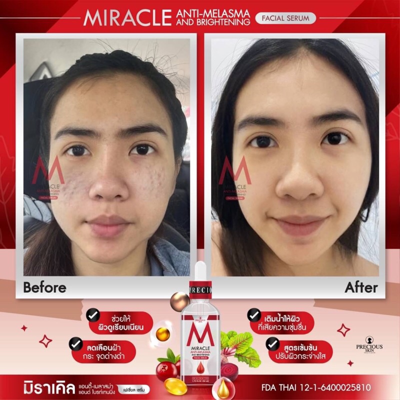 Miracle Anti-Melasma and Brightening Facial Serum 50ml มิราเคิล เซรั่มแก้ฝ้า เซรั่มผิวขาว