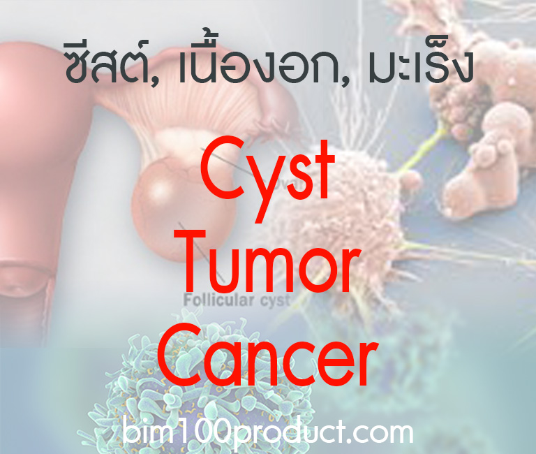 cyst,tumor,cancer
