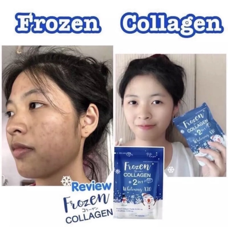 Frozen Collagen / Frozen Detox / Lachel Vitamin C / Lazel Gluta วิตามินอาหารเสริม