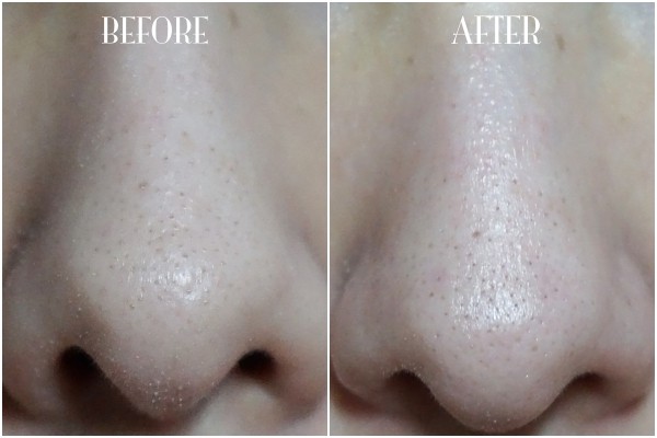 White Gel Hut Mun 22g ลอกสิวเวียดนาม