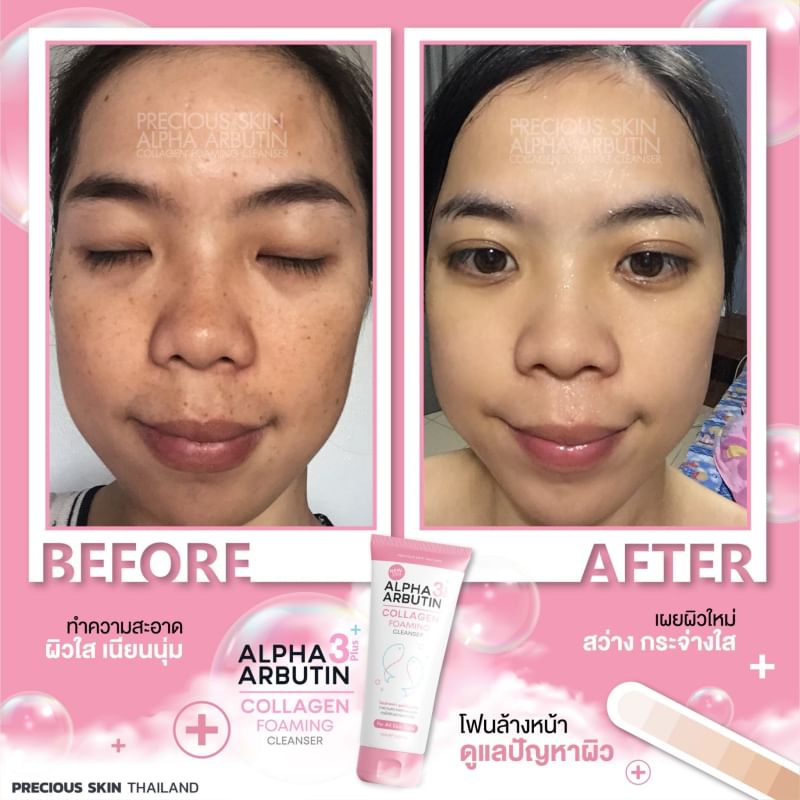 Alpha Arbutin 3+ Collagen Foaming Cleanser 120ml โฟมล้างหน้า คอลลาเจน