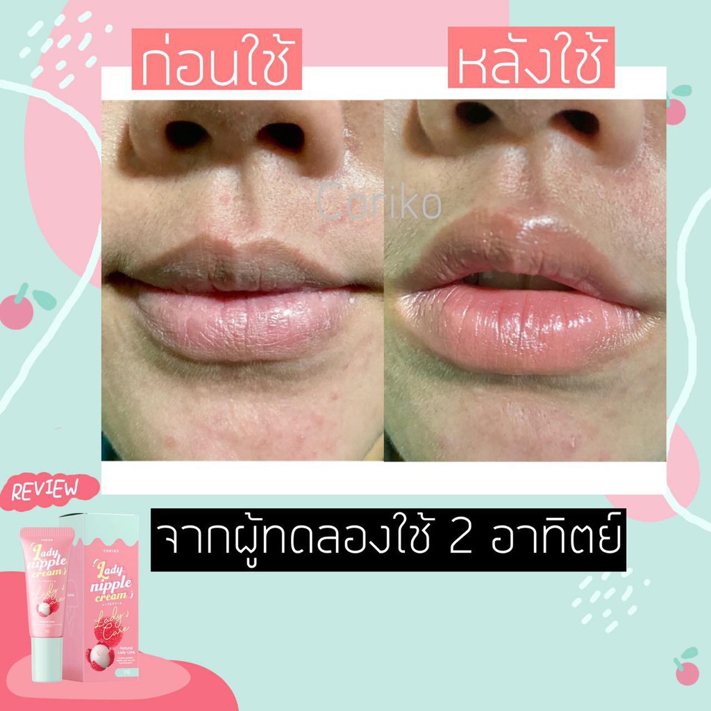 ลิปโคริโกะ Coriko lady nipple cream 7 g ลิปปากดำ ลิปแก้ปากดำลิ้นจี่ เลดี้ นิปเปิ้ล ลิปลิ้นจี่บำรุงปาก
