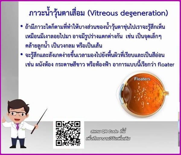 ภาวะน้ำวุ้นตาเสื่อม