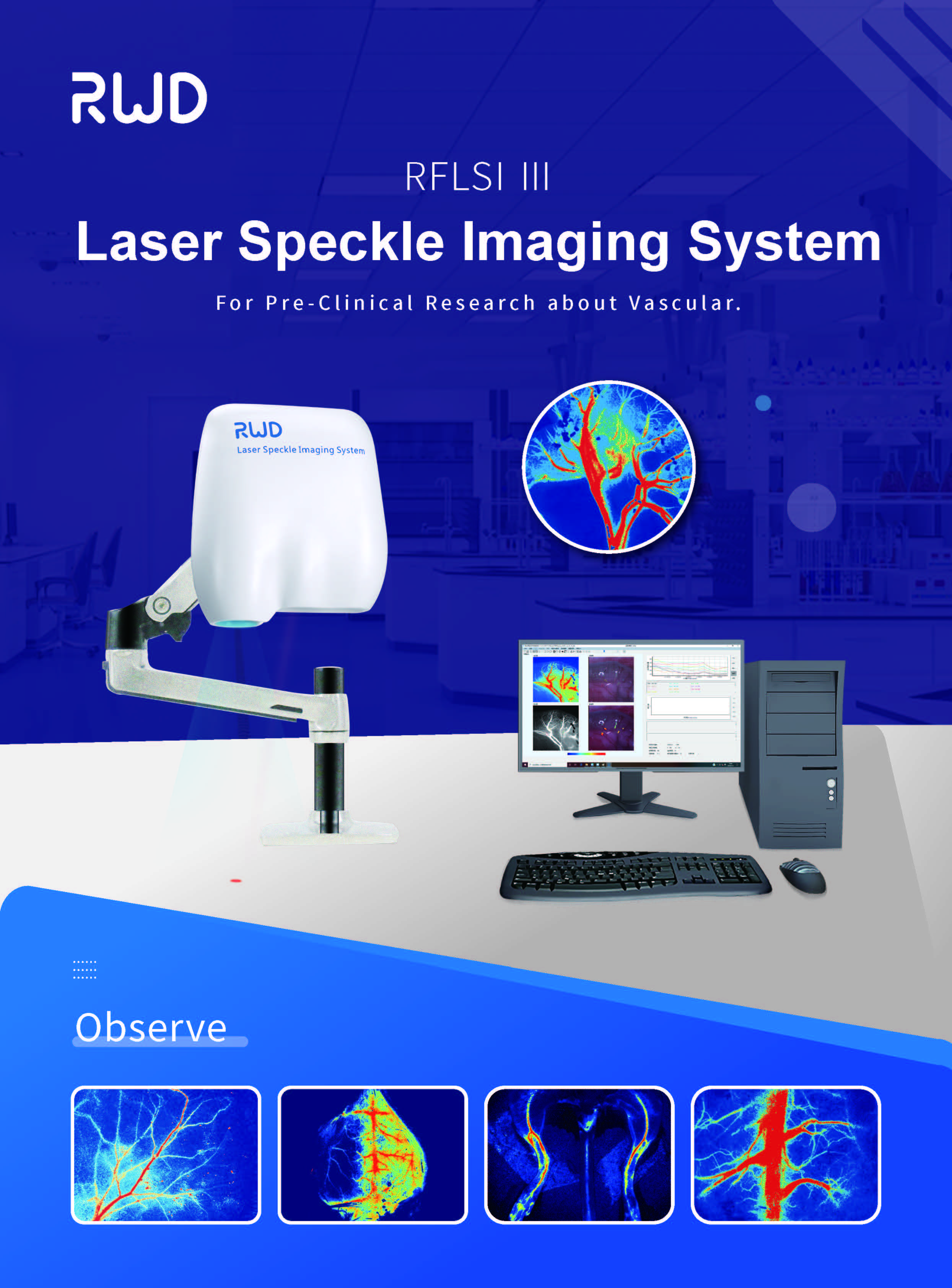 blood perfusion imaging system (Laser Speckle Contrast Analysis)