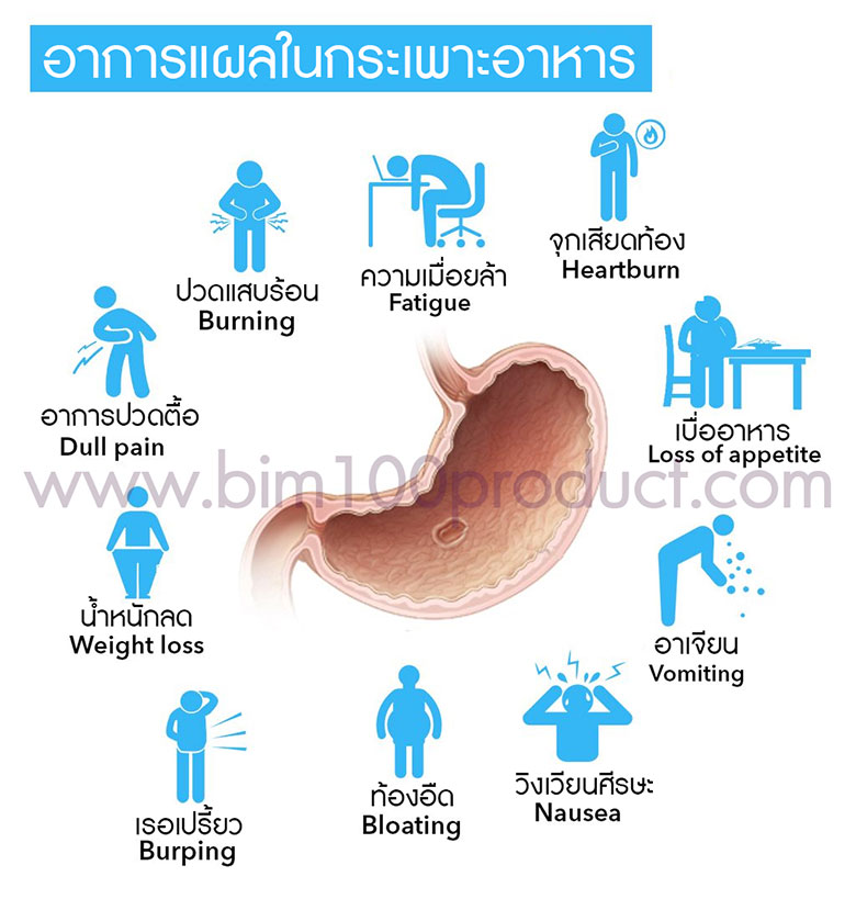 stomach ulcer