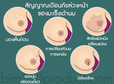สัญญาณเตือนมะเร็งเต้านม