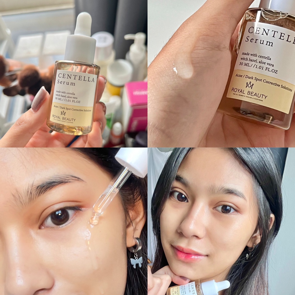 (1ขวด) Royal Beauty รอยัล บิวตี้ เซนเทลล่า เซรั่ม Centella Serum ชอตเข้มข้น 30มล.