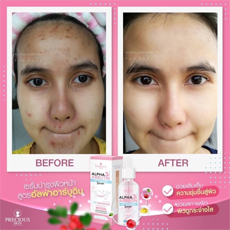 Precious Skin Alpha Arbutin Collagen Serum 50 ml (for face) เซรั่มอัลฟ่า-อาร์บูติน สูตรเข้มข้น