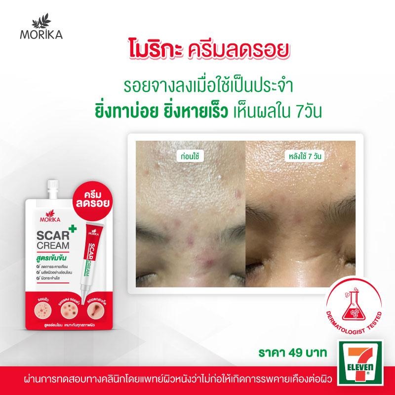 (6ซอง/กล่อง) Morika Scar Cream 5กรัม โมริกะ สการ์ ครีม #ครีมลดรอยสูตรเข้มข้น