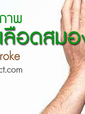 BIM100 ประสบการณ์ผู้ใช้กับปัญหาหลอดเลือดสมองตีบ